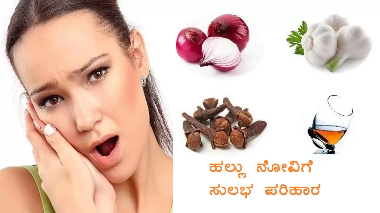 ಹಲ್ಲು ನೋವಿಗೆ ಪರಿಹಾರ-ಮನೆಮದ್ದು-itskannada