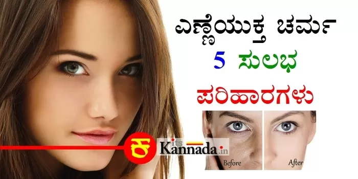 Top 5 Home Remedies For Oily Skin in Kannada-Kannada Health Tips