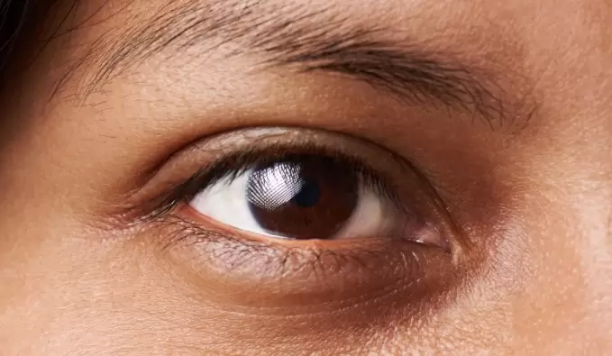 Homemade remedies for curing Dark circles in Kannada