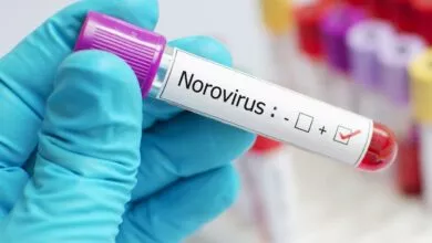 Norovirus, ನೊರೊವೈರಸ್ ಎಂದರೇನು? ಹೇಗೆ ಮುಂಜಾಗ್ರತೆ ವಹಿಸಬೇಕು.. Kannada News