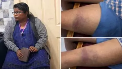 ಬೆಂಗಳೂರು ಖಾಸಗಿ ಶಾಲೆಯಲ್ಲಿ ಹೋಂವರ್ಕ್ ಮಾಡದ ಬಾಲಕನ ಮೇಲೆ ಶಿಕ್ಷಕಿಯಿಂದ ಹಲ್ಲೆ