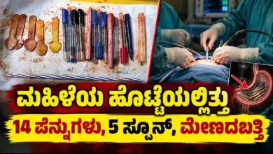 ಆಂಧ್ರಪ್ರದೇಶದ ಮಹಿಳೆಯ ಹೊಟ್ಟೆಯಿಂದ 14 ಪೆನ್ನುಗಳು, 5 ಸ್ಪೂನ್, ಮೇಣದಬತ್ತಿ ಹೊರತೆಗೆದ ವೈದ್ಯರು